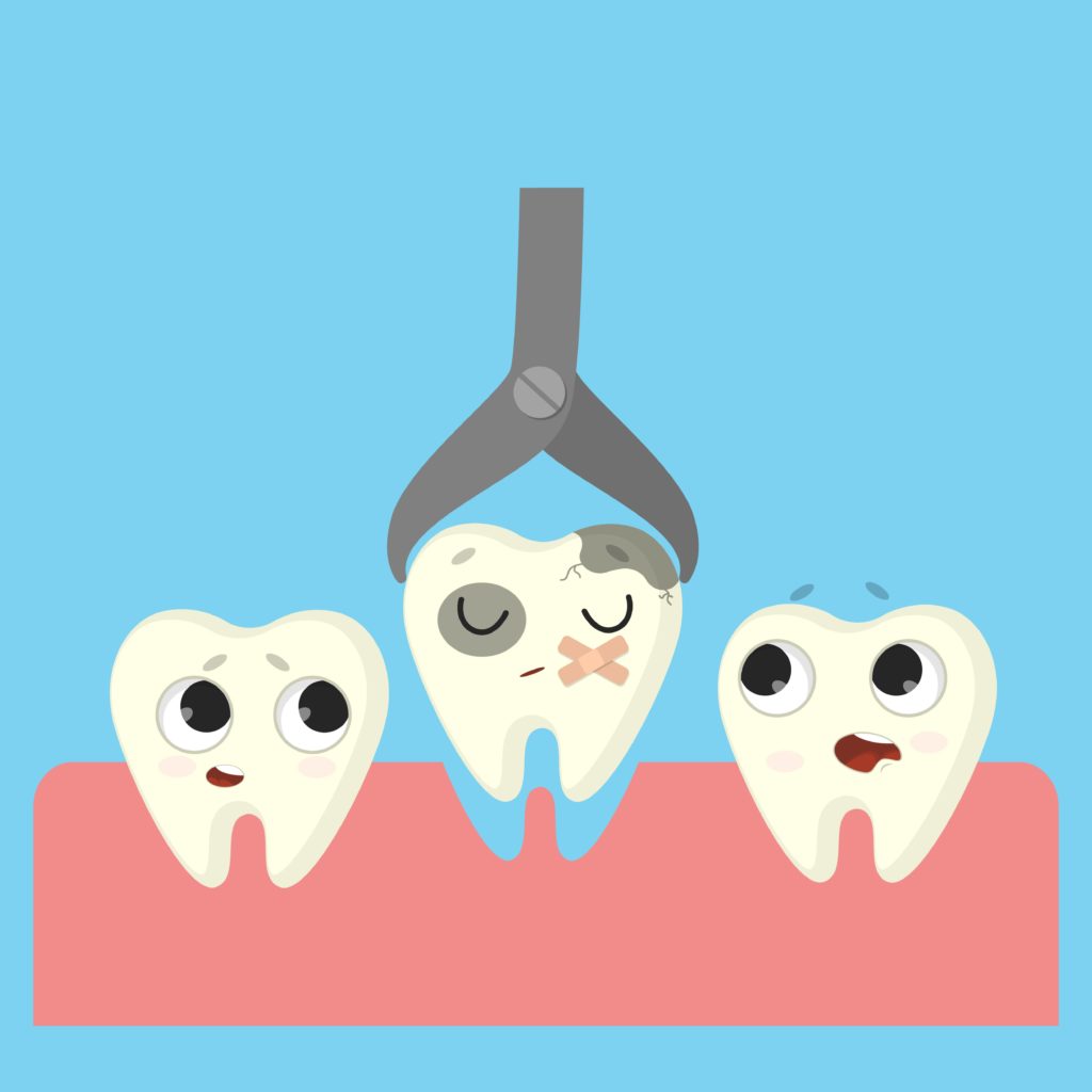 עקירות שיני חלב - ד"ר אבלין ושלר' רופאת שיניים המתמקדת בטיפול בחרדה דנטלית בילדים ומתבגרים